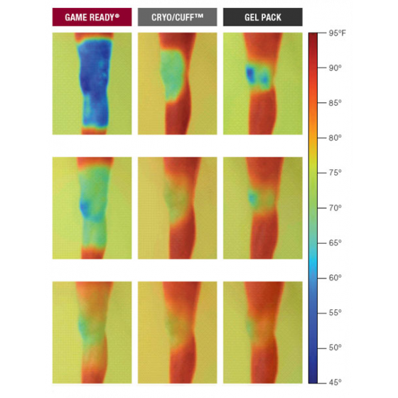 Cryothérapie compressive Game Ready - Pack Professionnel
